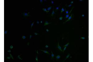 Immunofluorescence staining of U251 cells with ABIN7146149 at 1:100, counter-stained with DAPI.
