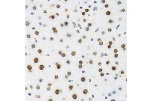 Immunohistochemistry of paraffin-embedded mouse liver using H2AFX antibody. (H2AFX 抗体)