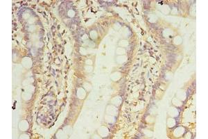 Immunohistochemistry of paraffin-embedded human small intestine tissue using ABIN7165992 at dilution of 1:100 (PRRC1 抗体  (AA 200-445))