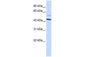 WB Suggested Anti-PSMD4 Antibody Titration: 0. (PSMD4/ASF 抗体  (N-Term))