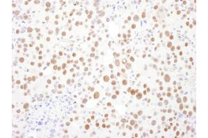 anti-PSME3 (PSME3) (AA 204-254) antibody