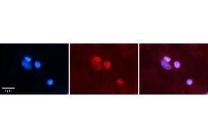 Rabbit Anti-NR1I2 Antibody    Formalin Fixed Paraffin Embedded Tissue: Human Adult heart  Observed Staining: Nuclei in adipocytes but not in cardiomyocytes Primary Antibody Concentration: 1:100 Secondary Antibody: Donkey anti-Rabbit-Cy2/3 Secondary Antibody Concentration: 1:200 Magnification: 20X Exposure Time: 0. (NR1I2 抗体  (N-Term))