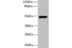 Western blot All lanes: ZNF562 antibody at 12 μg/mL + 293T whole cell lysate Secondary Goat polyclonal to rabbit IgG at 1/10000 dilution Predicted band size: 49, 41 kDa Observed band size: 49 kDa (ZNF562 抗体  (AA 201-426))