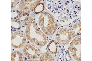 Immunohistochemistry (IHC) image for anti-Von Willebrand Factor (VWF) antibody (ABIN3029609)