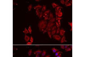 Immunofluorescence analysis of U2OS cells using PAICS Polyclonal Antibody (PAICS 抗体)