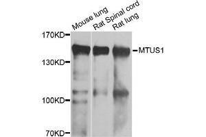 Western blot analysis of extracts of various cell lines, using MTUS1 antibody. (MTUS1 抗体)