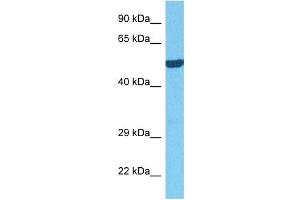 Host:  Rabbit  Target Name:  OASL  Sample Tissue:  Mouse Kidney  Antibody Dilution:  1ug/ml (OASL 抗体  (C-Term))