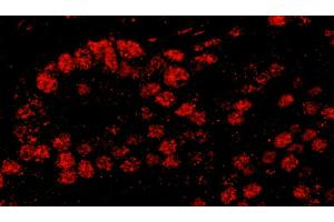 Immunofluorescence (IF) image for anti-PDS5, Regulator of Cohesion Maintenance, Homolog B (PDS5B) (AA 1200-1250) antibody (ABIN7455224)