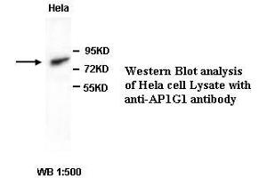 Image no. 1 for anti-Adaptor-Related Protein Complex 1, gamma 1 Subunit (AP1G1) antibody (ABIN791086) (gamma 1 Adaptin 抗体)