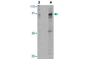 Western blot analysis of PAK7 in T24 lysate with PAK7 polyclonal antibody  at 2 and 4 ug/mL . (PAK7 抗体  (Internal Region))