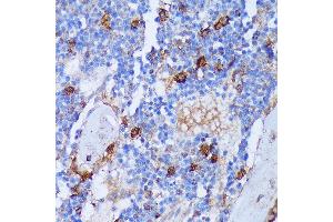 Immunohistochemistry of paraffin-embedded Rat bone marrow using P antibody (ABIN7269207) at dilution of 1:100 (40x lens).