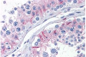 Human Testis: Formalin-Fixed, Paraffin-Embedded (FFPE) (ZYX 抗体  (AA 1-573))