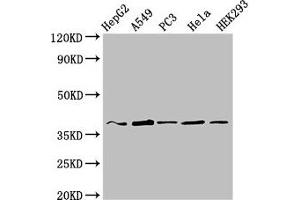 Western Blot Positive WB detected in: HepG2 whole cell lysate, A549 whole cell lysate, PC-3 whole cell lysate, Hela whole cell lysate, HEK293 whole cell lysate All lanes: CRK antibody at 3 μg/mL Secondary Goat polyclonal to rabbit IgG at 1/50000 dilution Predicted band size: 34, 23 kDa Observed band size: 37 kDa (Crk 抗体  (AA 40-196))