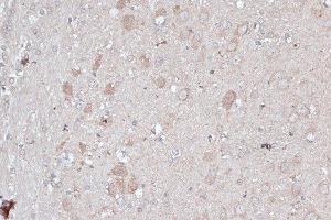 Immunohistochemistry of paraffin-embedded rat brain using MAP1LC3B antibody. (LC3B 抗体)