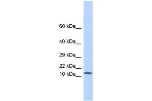 LGALS1 antibody used at 1 ug/ml to detect target protein. (LGALS1/Galectin 1 抗体)