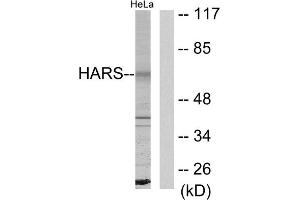 Western blot analysis of extracts from HeLa cells, using HARS antibody. (HARS1/Jo-1 抗体  (C-Term))
