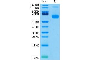 Biotinylated Human CD27 Ligand (Trimer) on Tris-Bis PAGE under reduced condition. (CD70 Protein (Trimer) (His tag,Biotin))