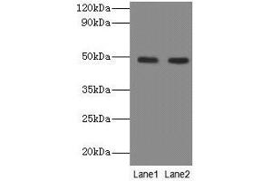 Western blot All lanes: NEU3 antibody at 2 μg/mL Lane 1: A549 whole cell lysate Lane 2: U251 whole cell lysate Secondary Goat polyclonal to rabbit IgG at 1/10000 dilution Predicted band size: 49, 52 kDa Observed band size: 49 kDa (Neu3 抗体  (AA 2-428))