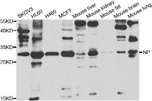 Western blot analysis of extracts of various cell lines, using PNP antibody. (NP 抗体)