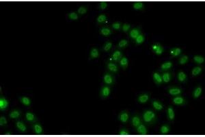 Immunofluorescence analysis of MCF7 cells using SOX5 Polyclonal Antibody (SOX5 抗体)