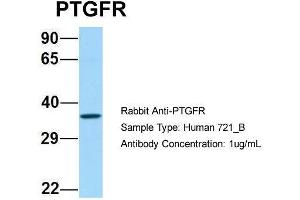 Host: Rabbit Target Name: PTGFR Sample Type: Human 721_B Antibody Dilution: 1. (PTGFR 抗体  (C-Term))