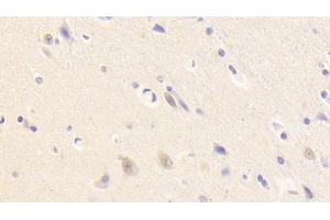Immunohistochemistry (IHC) image for anti-Neurotrophic tyrosine Kinase, Receptor, Type 3 (NTRK3) (AA 32-429) antibody (ABIN7443641)