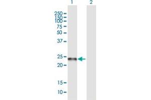 Western Blot analysis of C19orf50 expression in transfected 293T cell line ( H00079036-T01 ) by C19orf50 MaxPab polyclonal antibody. (C19orf50 抗体  (AA 1-176))
