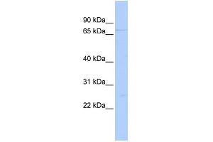 WB Suggested Anti-DDX59 Antibody Titration:  0. (DDX59 抗体  (Middle Region))