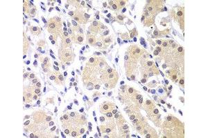 Immunohistochemistry of paraffin-embedded Human gastric using CHEK1 Polyclonal Antibody at dilution of 1:100 (40x lens). (CHEK1 抗体)