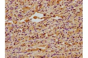 Immunohistochemistry (IHC) image for anti-DnaJ (Hsp40) Homolog, Subfamily A, Member 3 (DNAJA3) (AA 86-184) antibody (ABIN7150498)