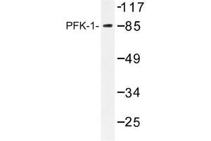 Image no. 2 for anti-Phosphofructokinase, Liver (PFKL) antibody (ABIN272176) (PFKL 抗体)