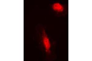 Immunofluorescent analysis of COPS3 staining in HeLa cells. (COPS3 抗体  (Center))
