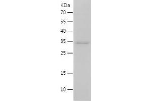 Western Blotting (WB) image for Interleukin 15 (IL15) (AA 49-162) protein (His-IF2DI Tag) (ABIN7123550)