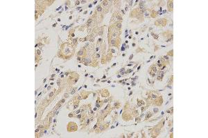 Immunohistochemistry of paraffin-embedded human stomach using SERPINF1 antibody at dilution of 1:200 (x400 lens). (PEDF 抗体)