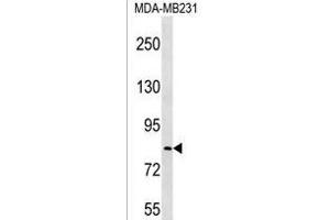 LRRC70 Antibody (C-term) (ABIN1537455 and ABIN2850345) western blot analysis in MDA-M cell line lysates (35 μg/lane). (LRRC70 抗体  (C-Term))