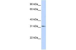 WB Suggested Anti-RHOXF2 Antibody Titration:  0. (RHOXF2 抗体  (Middle Region))