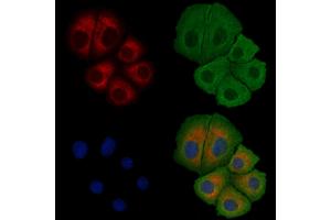 ABIN6258257 and ABIN6275216 staining Hela cells by IF/ICC. (LSP1 抗体  (C-Term))