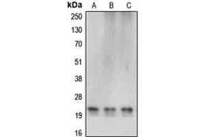 Western blot analysis of Cerebellin 4 expression in HEK293T (A), SP2/0 (B), rat liver (C) whole cell lysates.