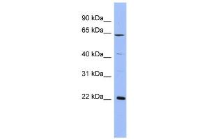 WB Suggested Anti-FREQ Antibody Titration:  0. (NCS1 抗体  (Middle Region))