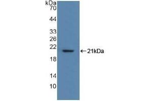 Detection of Recombinant MYL2, Human using Polyclonal Antibody to Myosin Light Chain 2 (MYL2) (MYL2 抗体  (AA 2-159))