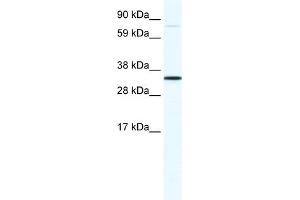 WB Suggested Anti-MSX1 Antibody Titration:  1. (MSX1 抗体  (N-Term))