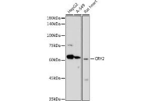 Western blot analysis of extracts of various cell lines, using CRY2 antibody (ABIN6130207, ABIN6139069, ABIN6139071 and ABIN6222617) at 1:1000 dilution. (CRY2 抗体  (AA 455-614))