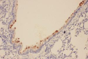 Immunohistochemistry (IHC) image for anti-SRY (Sex Determining Region Y)-Box 2 (SOX2) (AA 171-183), (Middle Region) antibody (ABIN3044477)