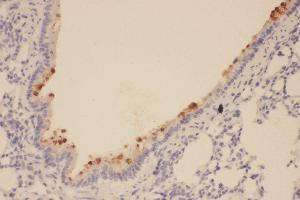Anti-SOX2 antibody, IHC(P) IHC(P): Rat Lung Tissue (SOX2 抗体  (Middle Region))