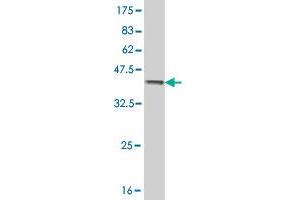 Western Blot detection against Immunogen (36. (AKR1C2 抗体  (AA 224-323))