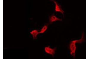 ABIN6275338 staining Hela by IF/ICC. (PDRG1 抗体  (Internal Region))