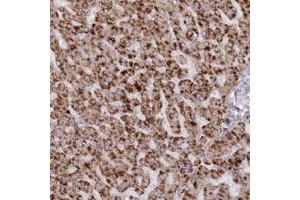 Immunohistochemical staining (Formalin-fixed paraffin-embedded sections) of human liver with ARSB polyclonal antibody  shows strong cytoplasmic positivity in hepatocytes. (Arylsulfatase B 抗体)