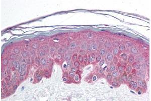 Human Skin (formalin-fixed, paraffin-embedded) stained with BRD7 antibody ABIN214730 at 10 ug/ml followed by biotinylated goat anti-rabbit IgG secondary antibody ABIN481713, alkaline phosphatase-streptavidin and chromogen. (BRD7 抗体  (C-Term))