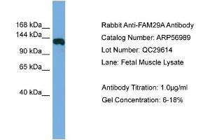 WB Suggested Anti-FAM29A  Antibody Titration: 0. (FAM29A 抗体  (Middle Region))