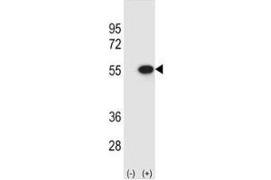 Western blot analysis of Reptin antibody and 293 cell lysate (2 ug/lane) either nontransfected (Lane 1) or transiently transfected (2) with the RUVBL2 gene. (RUVBL2 抗体  (AA 400-430))